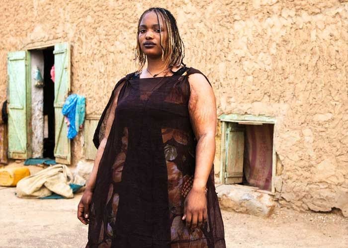 Μαυριτανία: το δράμα μιας γυναίκας που την υποχρέωσαν να γίνει παχύσαρκη